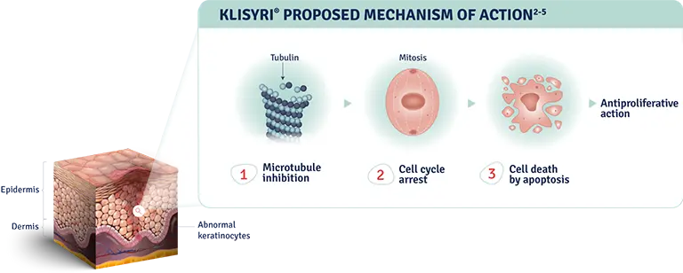 Klisyri proposed mechanism of action